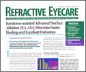 Keratome-assisted ASA Keratome-assisted ASA