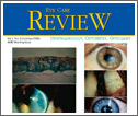 Corneal Collagen Cross Linking Corneal Collagen Cross Linking